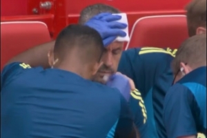 ??諾丁漢森林助教慶祝進(jìn)球太激動劃破頭，縫了六針