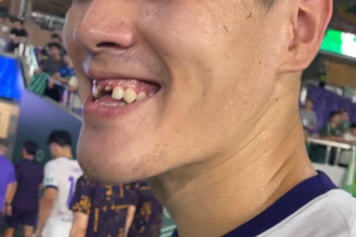 ??太慘了！津門虎0-2不敵浙江，中衛(wèi)王獻均門牙在比賽中被撞掉