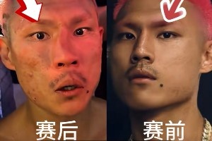 慘遭“整容”！惡鼠遭威姆斯TKO 鼻梁骨被打歪鮮血直流??